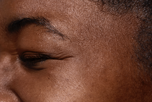 La glycation : ce processus silencieux qui fait vieillir votre peau