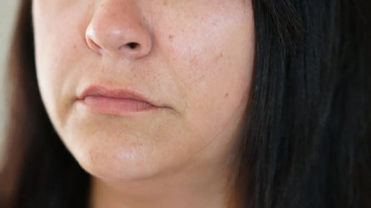 Pourquoi votre peau perd-elle son éclat avec l’âge ? Hectyl