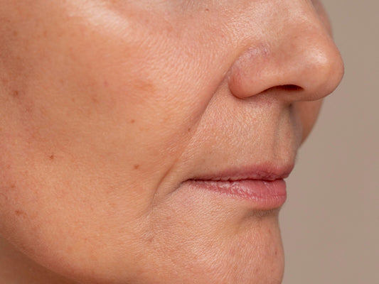 Pourquoi votre peau perd-elle son éclat avec l’âge ?