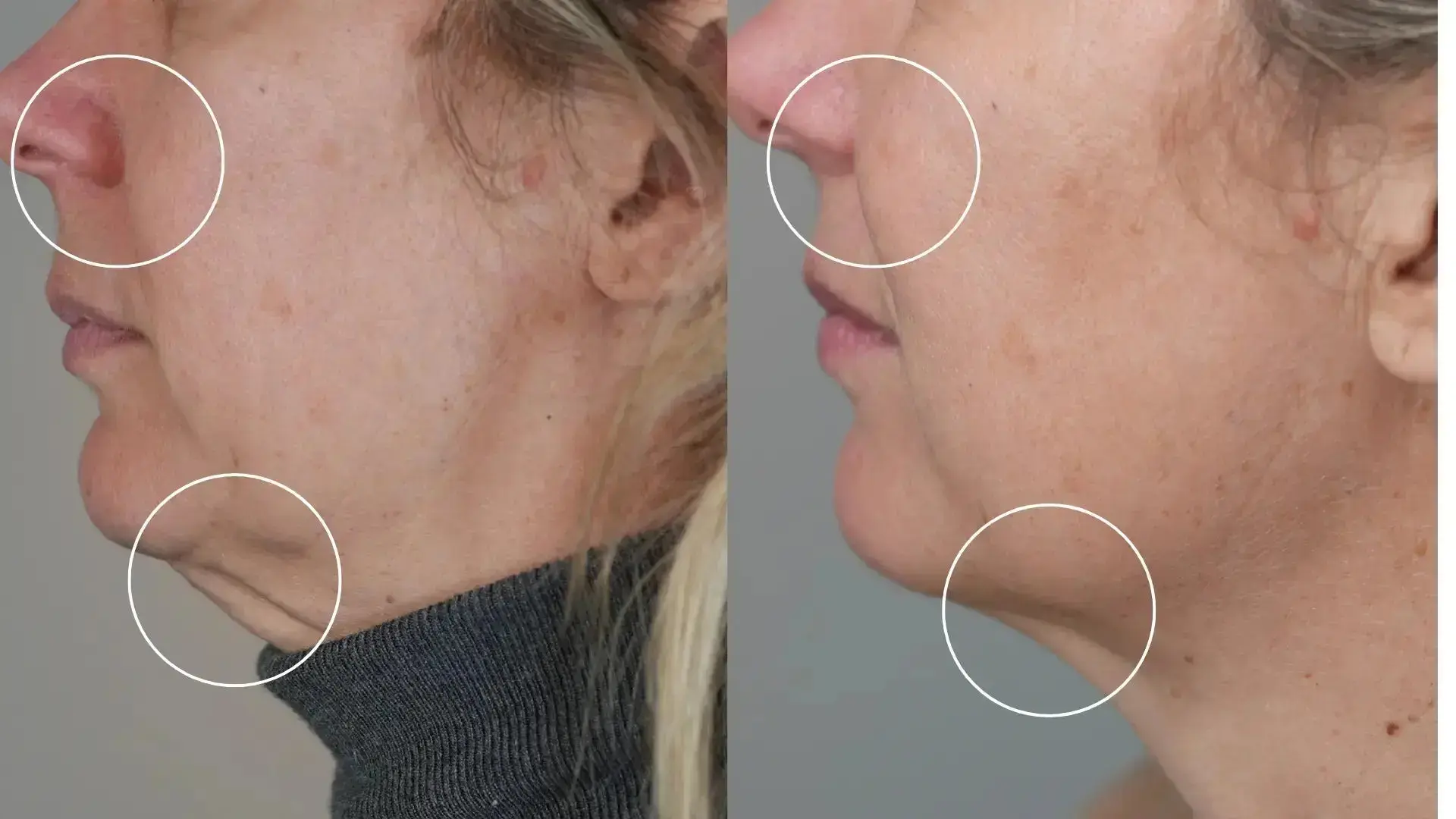 Programme Anti-Âge Sublimation Globale – Cure Complète Peau Hectyl