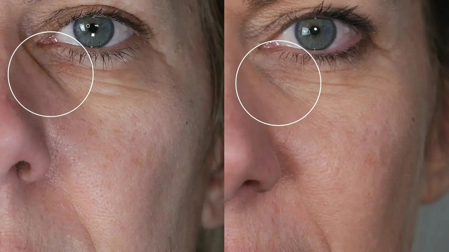 Programme Anti-Âge Réparation – Cure Ciblée Rides & Fermeté Hectyl