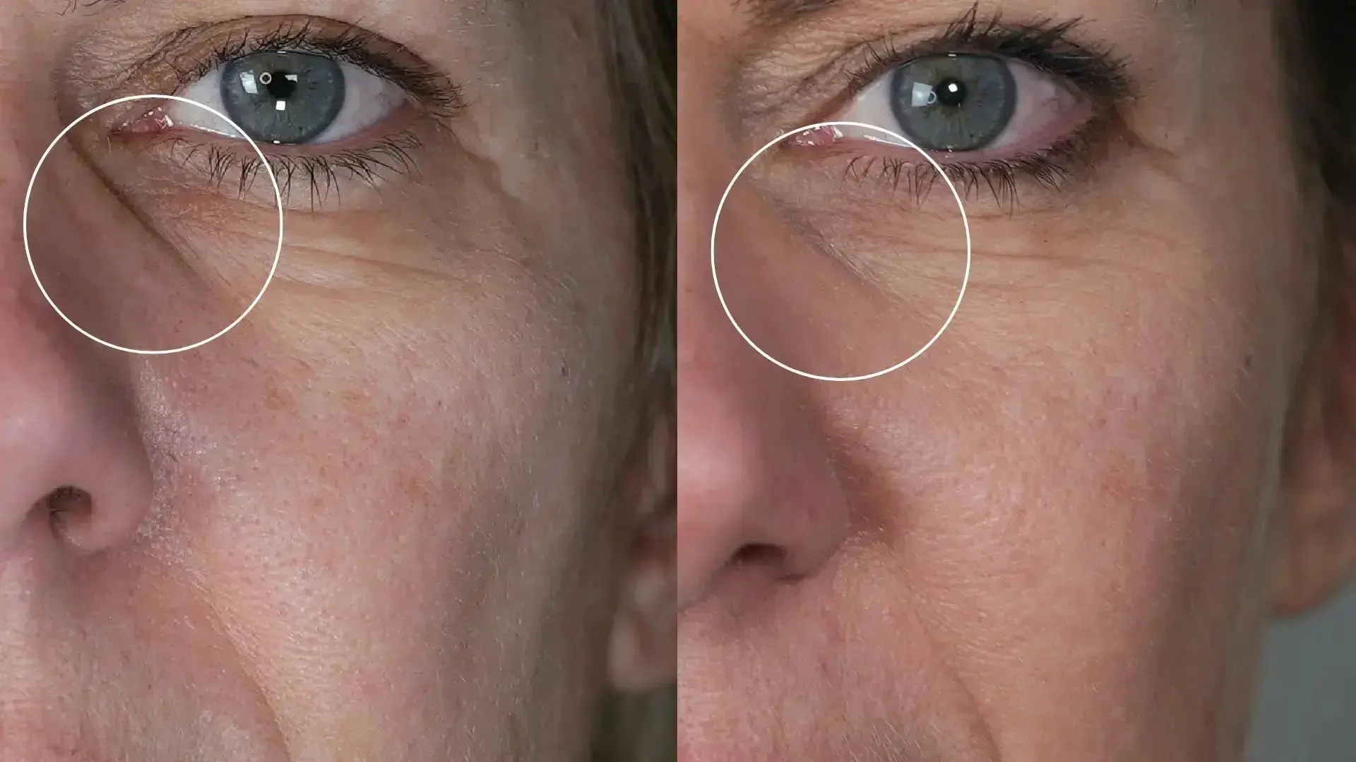 Programme Anti-Âge Réparation – Cure Ciblée Rides & Fermeté Hectyl