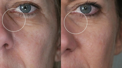 Programme Anti-Âge Réparation – Cure Ciblée Rides & Fermeté Hectyl