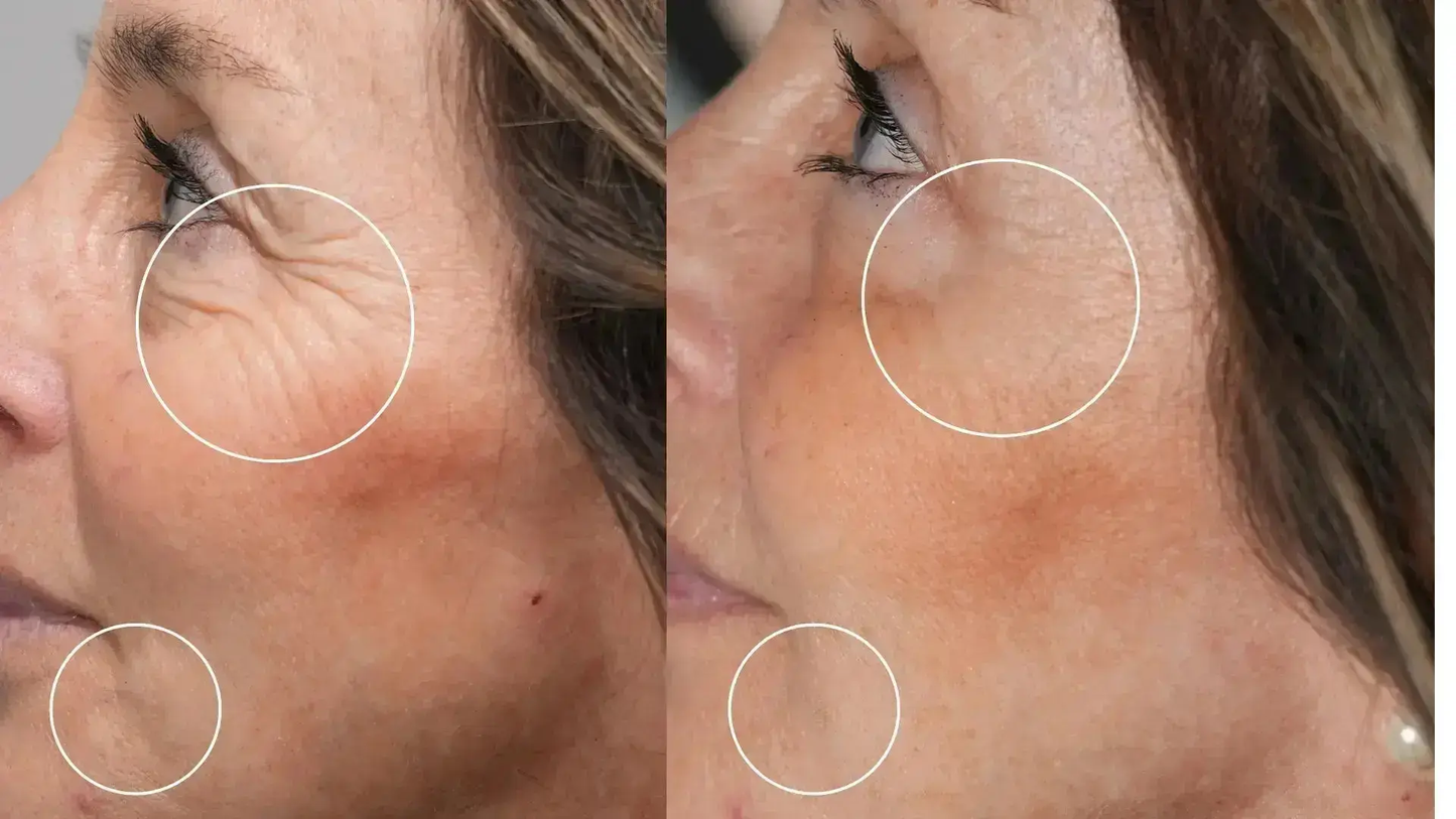 Programme Anti-Âge Sublimation Globale – Cure Complète Peau Hectyl