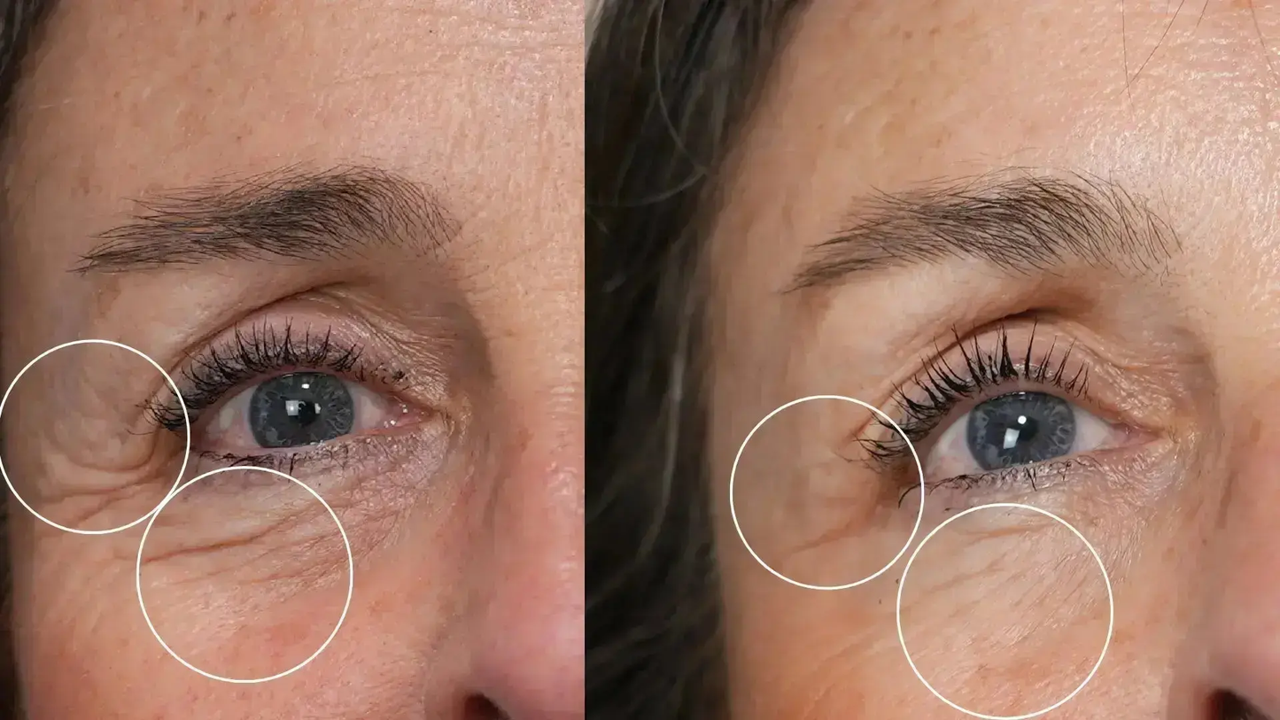 Programme Anti-Âge Sublimation Globale – Cure Complète Peau Hectyl