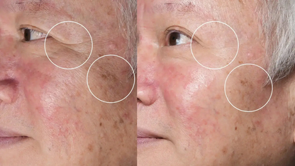 Programme Anti-Âge Sublimation Globale – Cure Complète Peau Hectyl