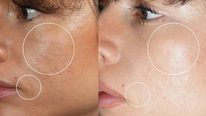 Programme Anti-Âge Sublimation Globale – Cure Complète Peau Hectyl